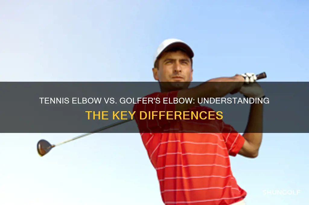 are tennis elbow and golfer