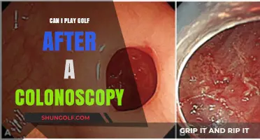 Golf After Colonoscopy: When Can You Safely Return to the Course?