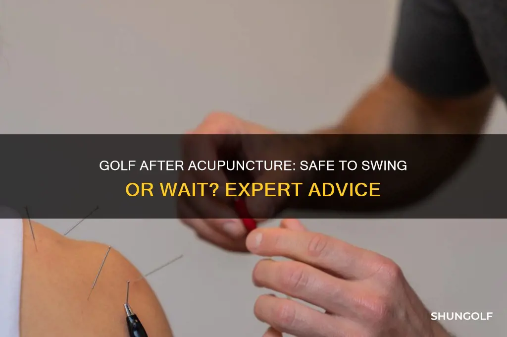 can i play golf after an acupuncture treatment