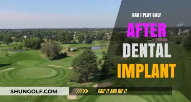 Golf After Dental Implants: What You Need to Know
