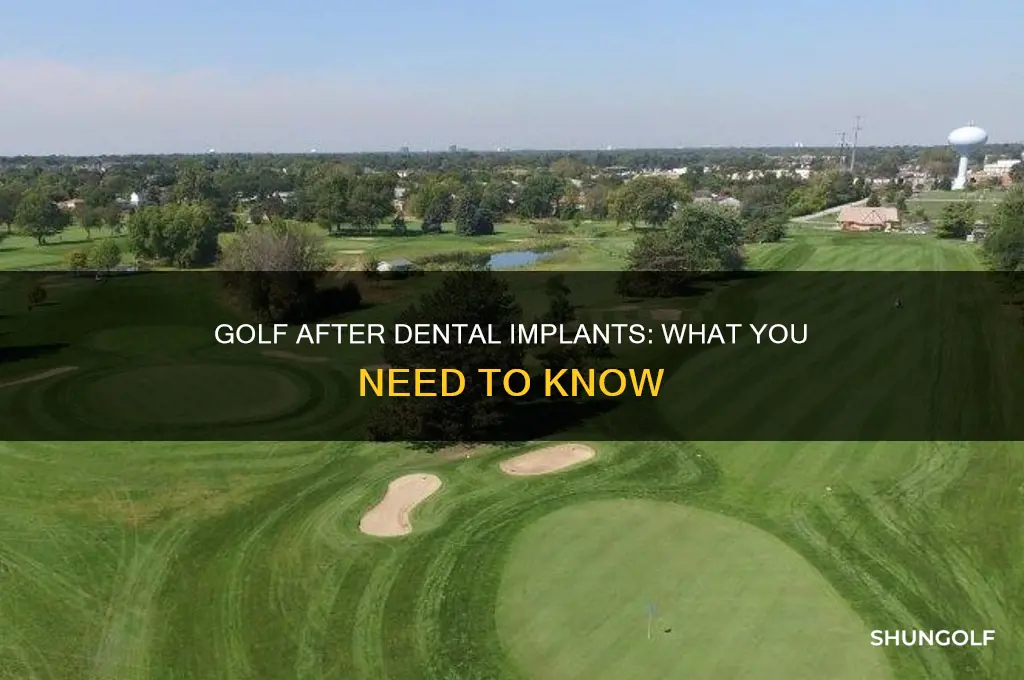 can i play golf after dental implant