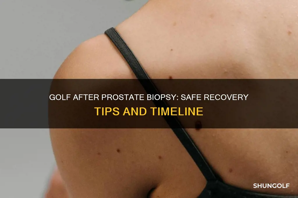 can i play golf after prostate biopsy