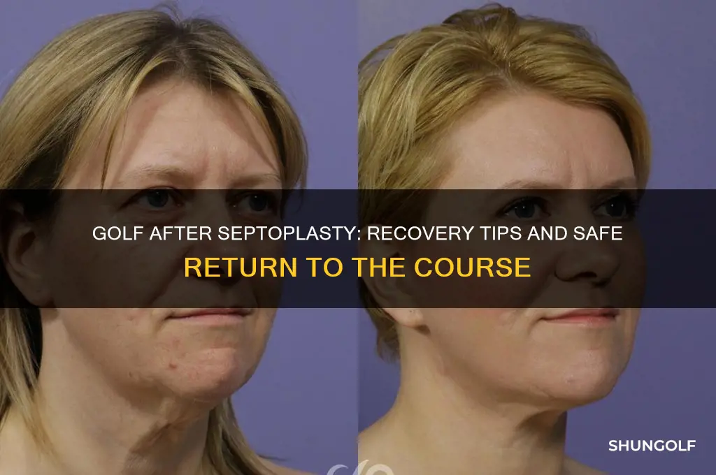 can i play golf after septoplasty