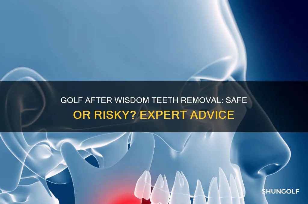 can i play golf after wisdom teeth removal