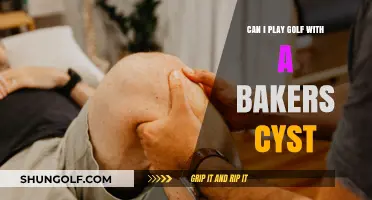 Golfing with a Baker's Cyst: Tips for Safe Play and Comfort