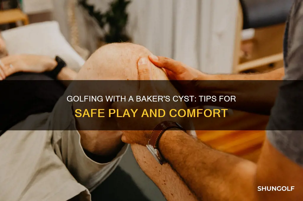can i play golf with a bakers cyst