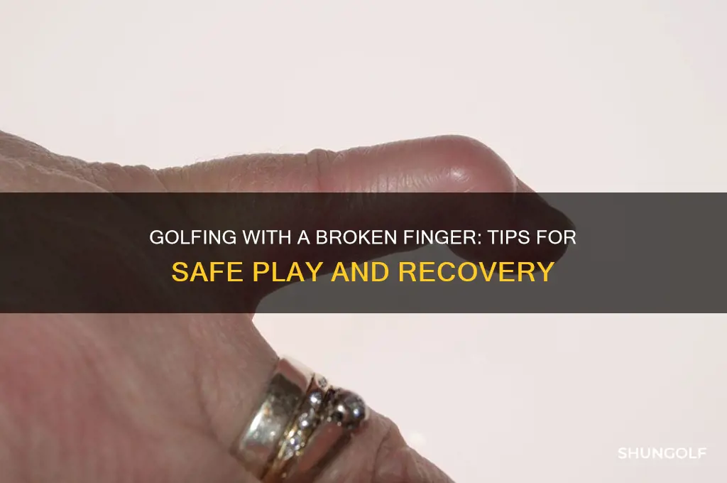 can i play golf with a broken finger