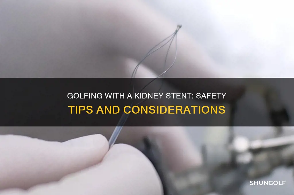 can i play golf with a kidney stent