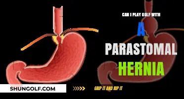 Golfing with a Parastomal Hernia: Tips for Safe Play