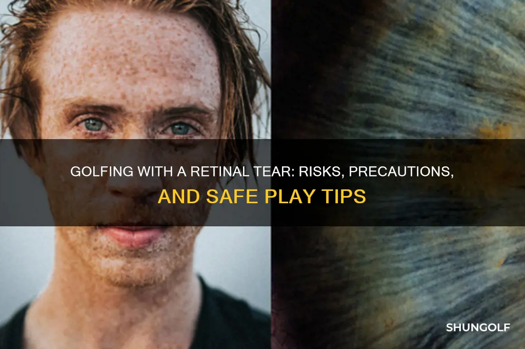 can i play golf with a retinal tear