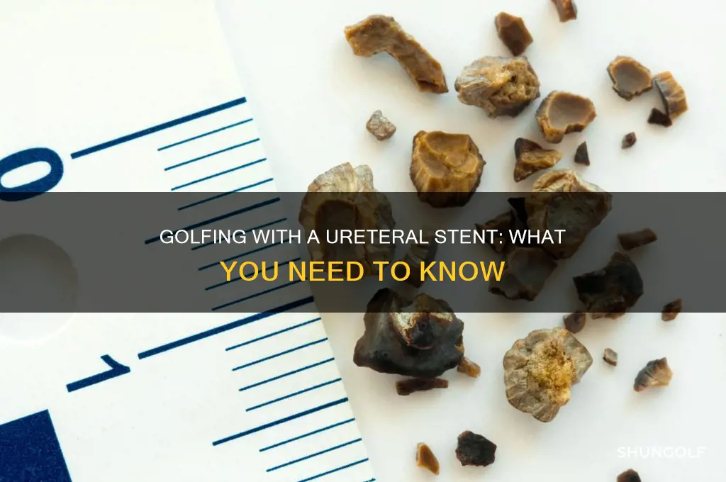 can i play golf with a ureteral stent