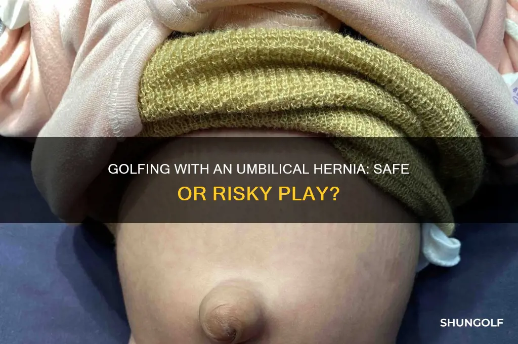 can i play golf with an umbilical hernia