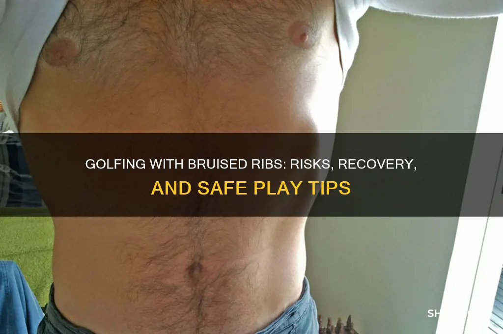 can i play golf with bruised ribs