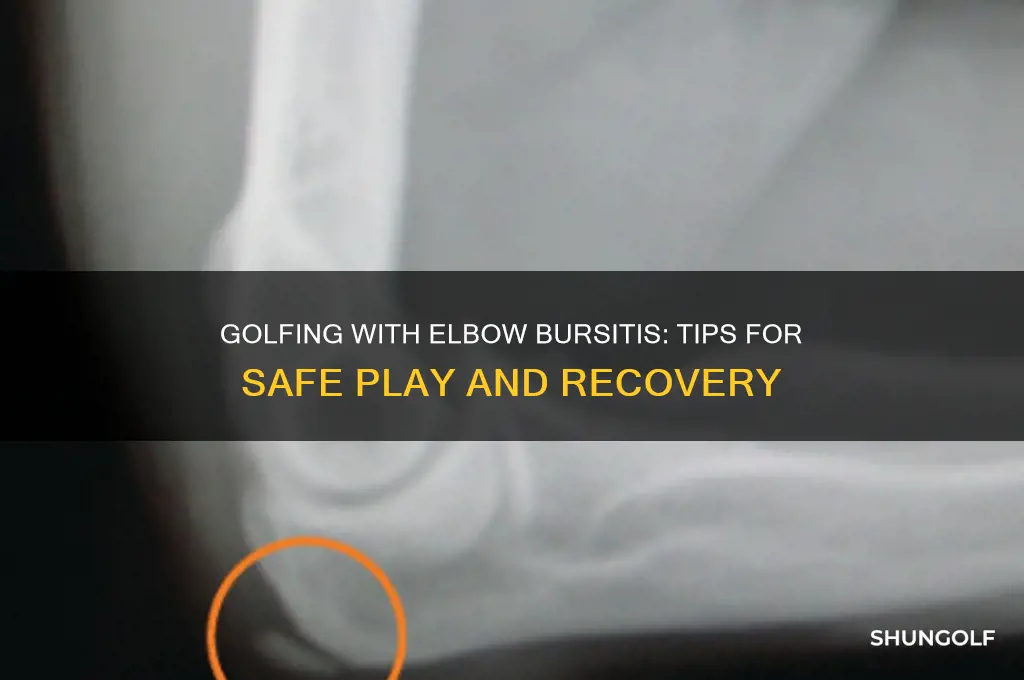 can i play golf with elbow bursitis