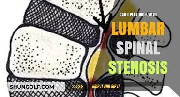 Golfing with Lumbar Spinal Stenosis: Tips for Safe Play
