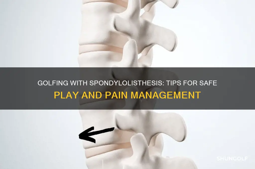 can i play golf with spondylolisthesis