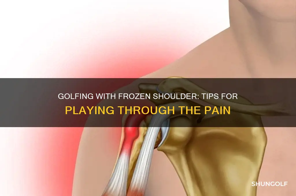 can i still play golf with frozen shoulder