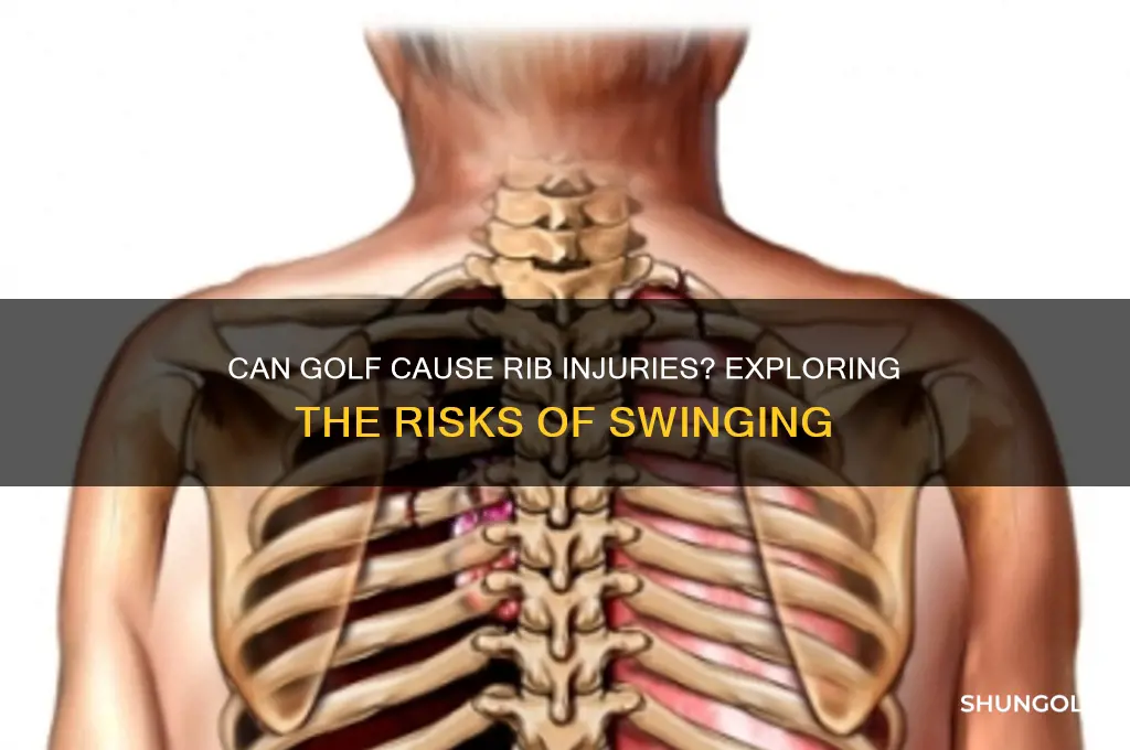 can you break a rib playing golf