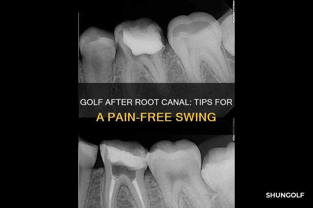 can you play golf after a root canal