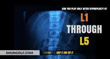 Golf After Kyphoplasty: L1-L5 Recovery and Swing Safety Tips