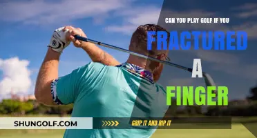 Golf with a Fractured Finger: Tips for Safe Play and Recovery