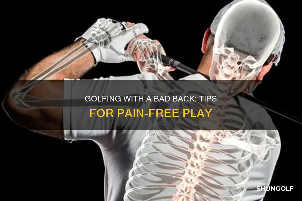 can you play golf with a bad back