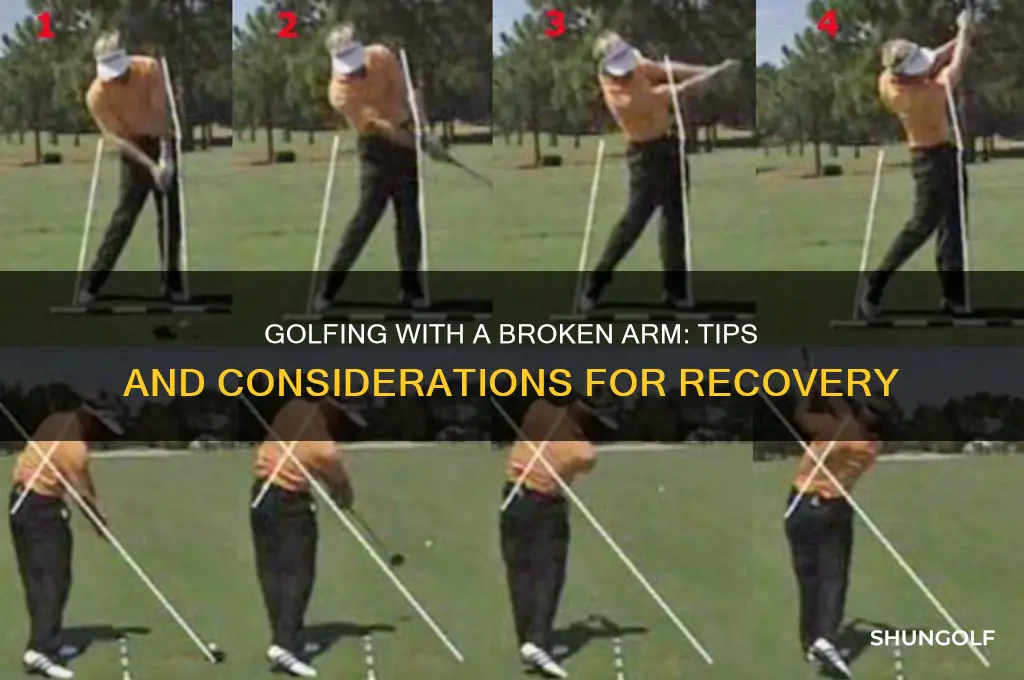 can you play golf with a broken arm