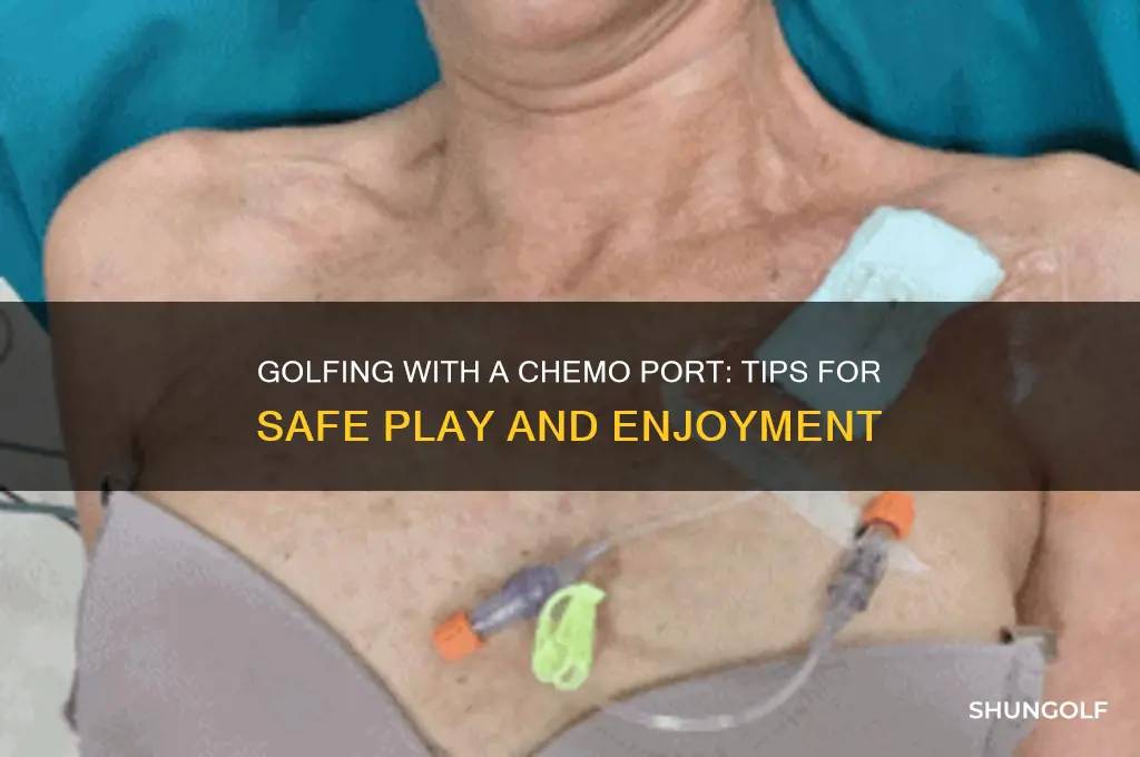 can you play golf with a chemo port