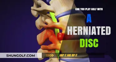 Golfing with a Herniated Disc: Tips for Safe Play and Recovery