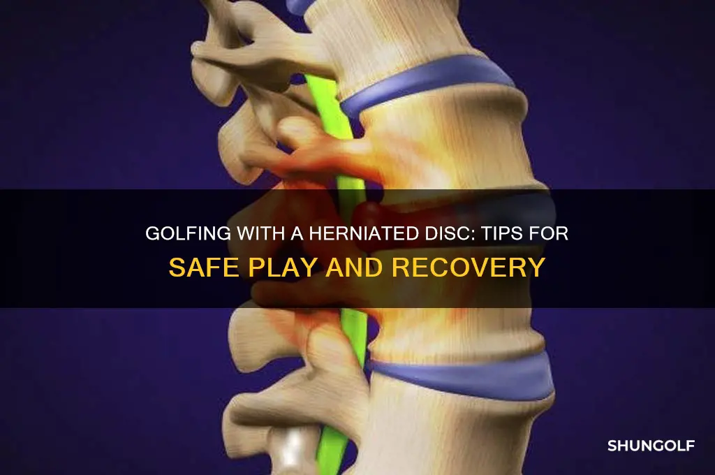can you play golf with a herniated disc