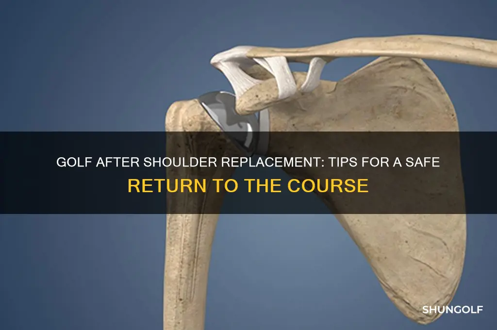can you play golf with a shoulder replacement