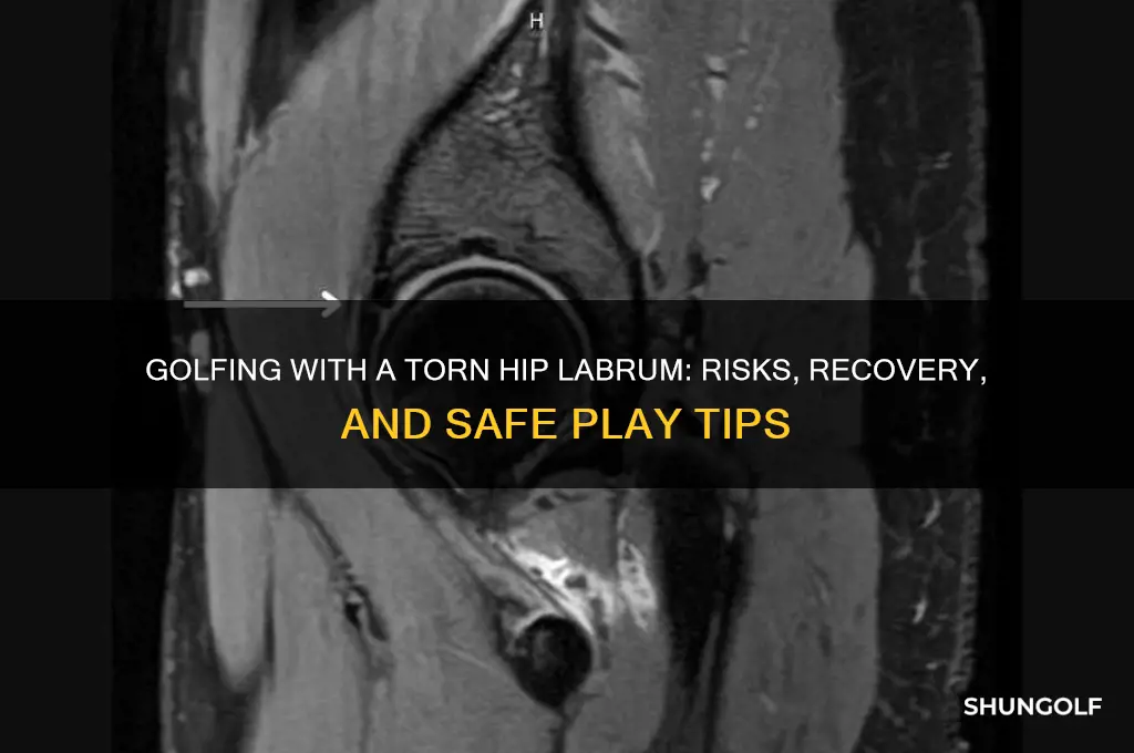 can you play golf with a torn hip labrum