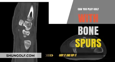 Playing Golf with Bone Spurs: Tips for Pain-Free Swings