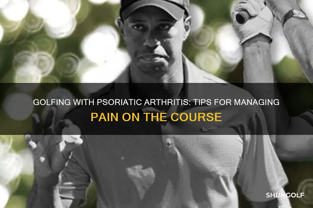 can you play golf with psoriatic arthritis