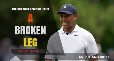 Tiger Woods' Unbelievable Golf Game: Did He Play with a Broken Leg?