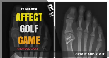 How Bone Spurs Impact Your Golf Swing and Performance