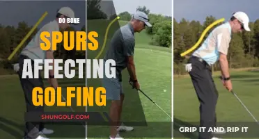 Golfing with Bone Spurs: How to Adapt Your Swing