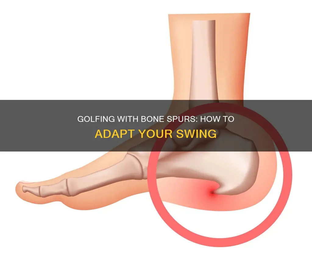 do bone spurs affecting golfing