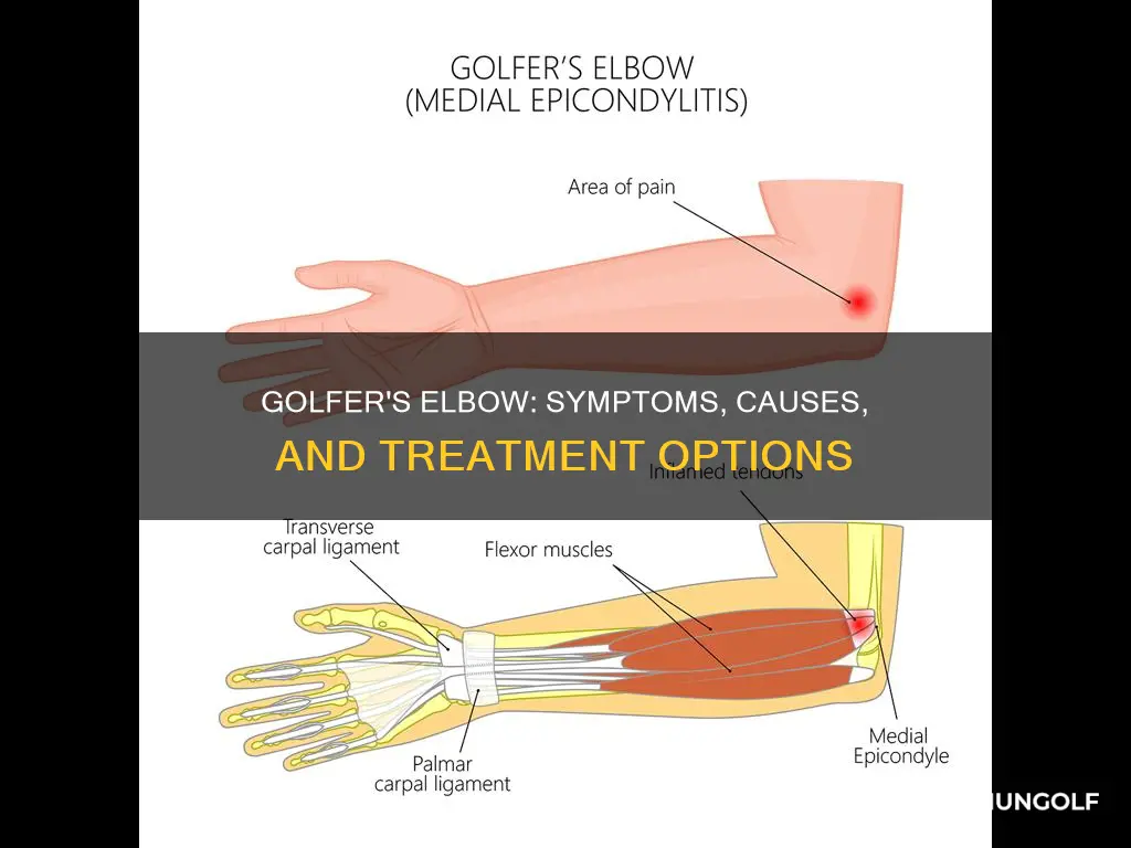 do i have golfer