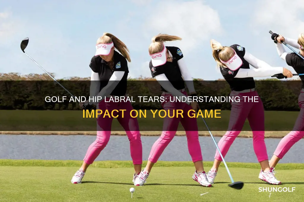 does golf exacerbate a hip labral tear