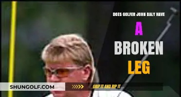 John Daly's Leg Injury: Fact-Checking the Broken Leg Rumors
