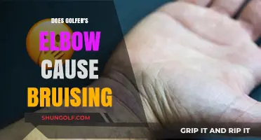 Golfer's Elbow: Can It Cause Bruising?