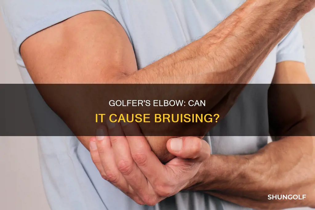 does golfer