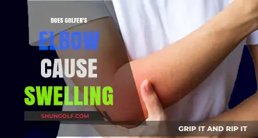 Golfer's Elbow: Swelling and Pain Explained