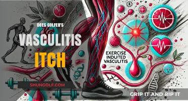 Golfer's Vasculitis: Understanding the Itch and How to Relieve It