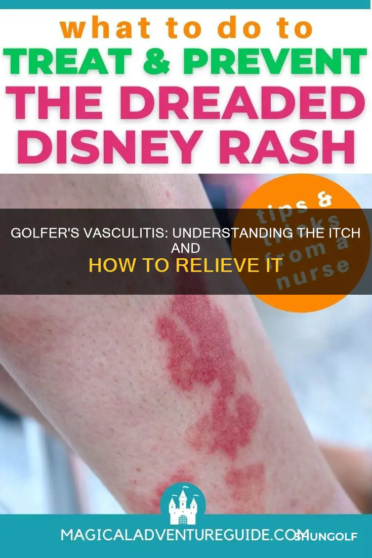 does golfer