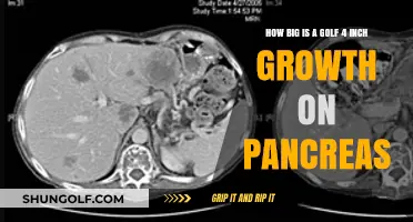 Understanding a 4-Inch Pancreatic Growth: Size, Impact, and Concerns