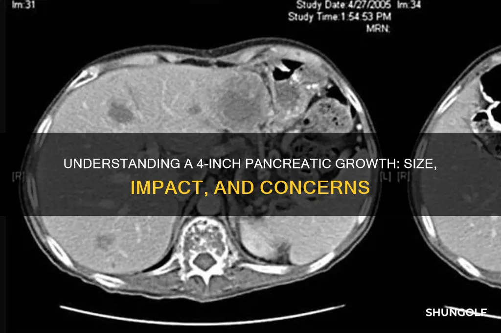 how big is a golf 4 inch growth on pancreas
