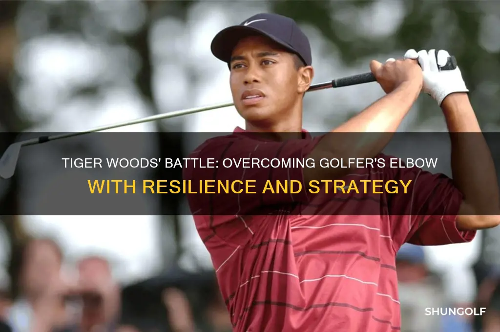 how did tiger woods fight golfer elbow