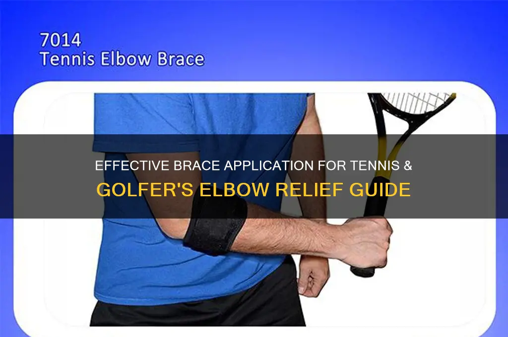 how do i apply a brace for tennis golfer